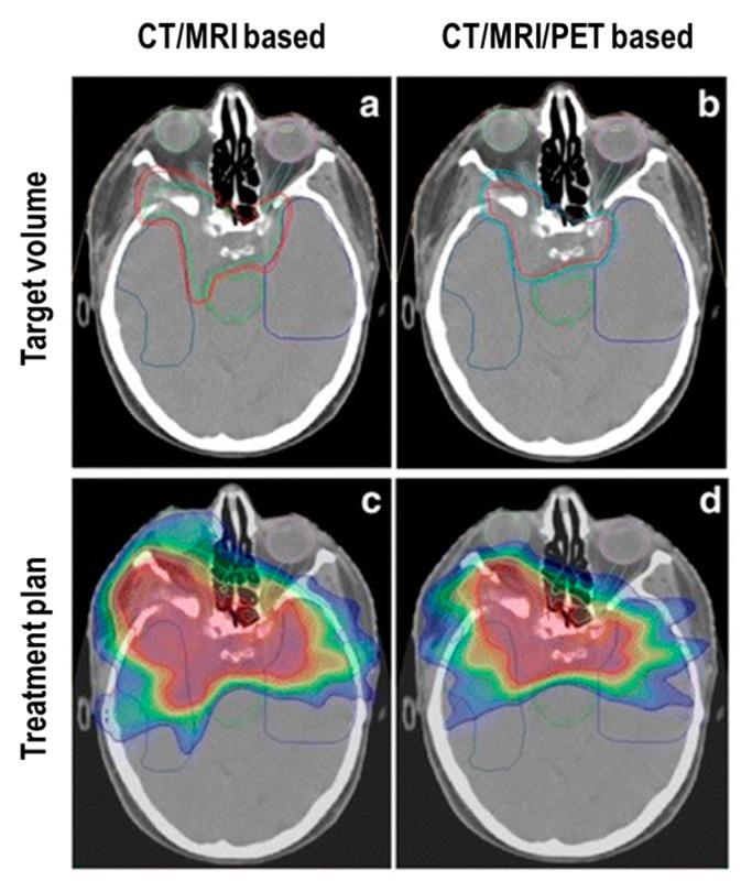 https://cdn.ncbi.nlm.nih.gov/pmc/blobs/d729/6826849/33c721686cf0/cancers-11-01412-g002.jpg