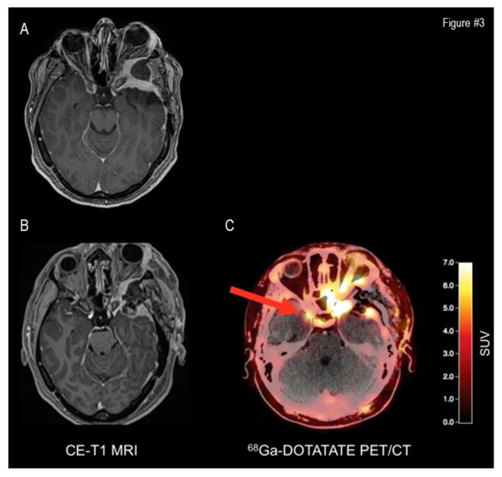 https://cdn.ncbi.nlm.nih.gov/pmc/blobs/d729/6826849/74c285b0fa89/cancers-11-01412-g003.jpg