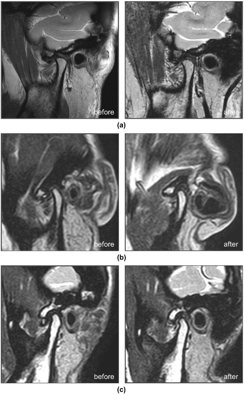 https://cdn.ncbi.nlm.nih.gov/pmc/blobs/d72a/11219320/d98760736331/gr10.jpg