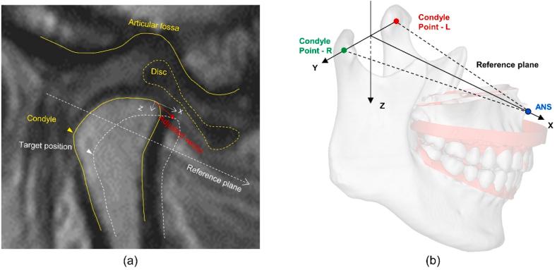 https://cdn.ncbi.nlm.nih.gov/pmc/blobs/d72a/11219320/f20692046a7a/gr5.jpg