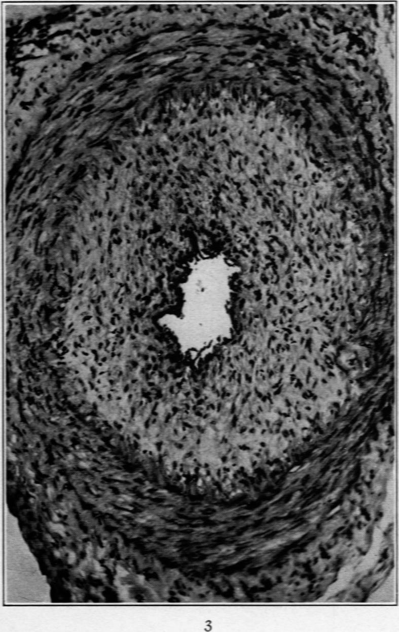 https://cdn.ncbi.nlm.nih.gov/pmc/blobs/d72c/2007297/16a2a2974677/amjpathol00612-0066-c.jpg
