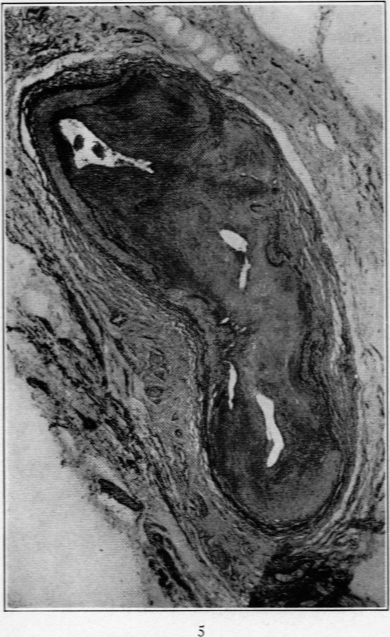 https://cdn.ncbi.nlm.nih.gov/pmc/blobs/d72c/2007297/1d8821a97cce/amjpathol00612-0068-a.jpg