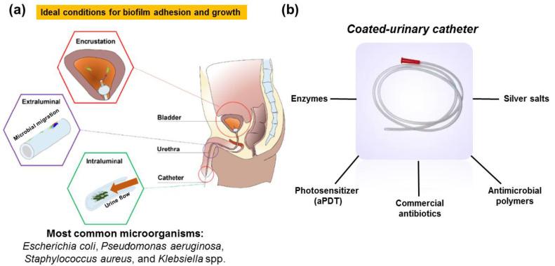https://cdn.ncbi.nlm.nih.gov/pmc/blobs/d732/9785902/e6652e6addb0/microorganisms-10-02484-g001.jpg
