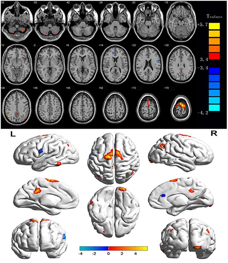 https://cdn.ncbi.nlm.nih.gov/pmc/blobs/d73d/6664059/f720ff8e3c7d/fnins-13-00743-g001.jpg