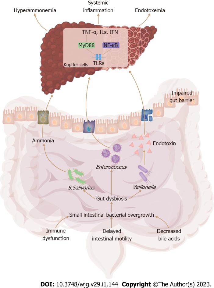 https://cdn.ncbi.nlm.nih.gov/pmc/blobs/d73d/9850958/3bd0f83209ae/WJG-29-144-g001.jpg