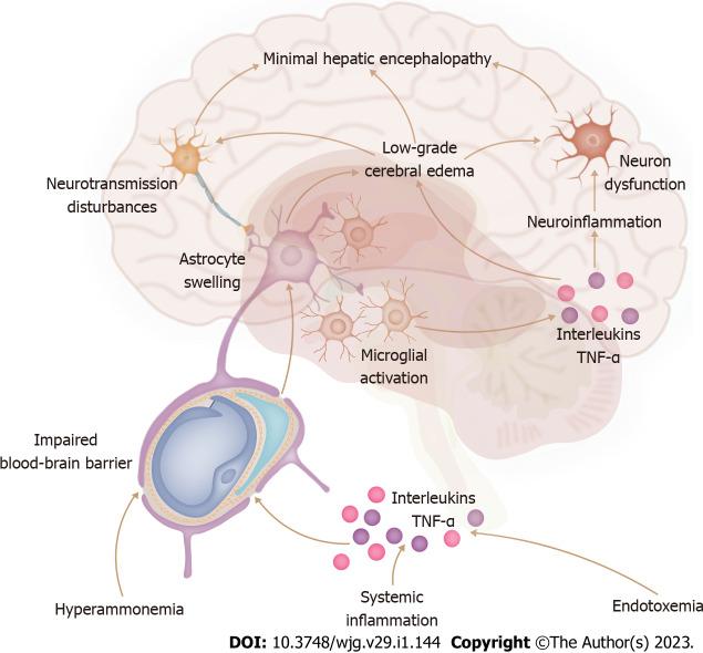 https://cdn.ncbi.nlm.nih.gov/pmc/blobs/d73d/9850958/d7d760d171b4/WJG-29-144-g002.jpg