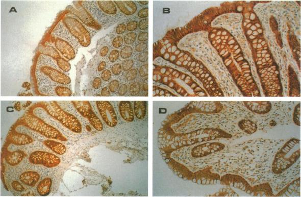 https://cdn.ncbi.nlm.nih.gov/pmc/blobs/d741/1858309/5b5f9d57d3fa/amjpathol00030-0095-a.jpg
