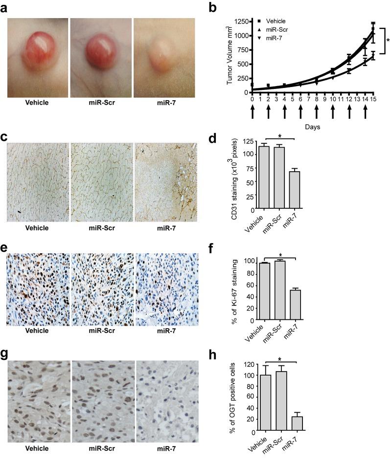 https://cdn.ncbi.nlm.nih.gov/pmc/blobs/d741/4196156/a6dbdd5b9ca6/oncotarget-05-6687-g005.jpg
