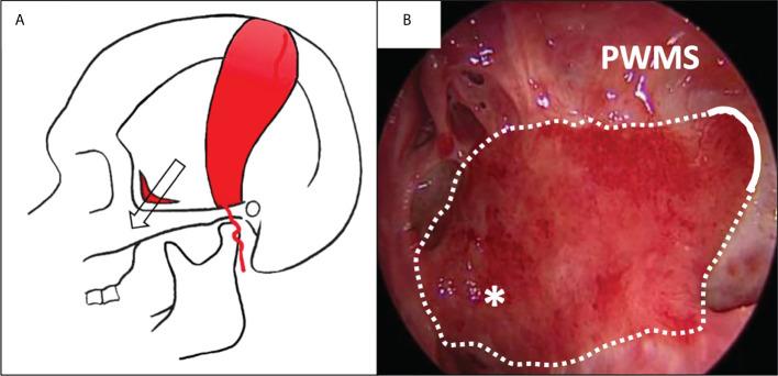 https://cdn.ncbi.nlm.nih.gov/pmc/blobs/d743/9530815/939b18be27a0/fonc-12-1013801-g004.jpg