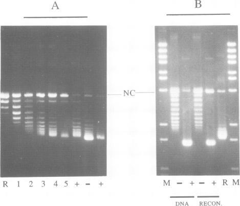 https://cdn.ncbi.nlm.nih.gov/pmc/blobs/d74b/452658/35f57437b1b4/emboj00100-0146-b.jpg
