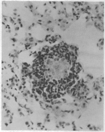 https://cdn.ncbi.nlm.nih.gov/pmc/blobs/d74f/276885/c7bf56e6f6c5/jbacter00406-0490-b.jpg