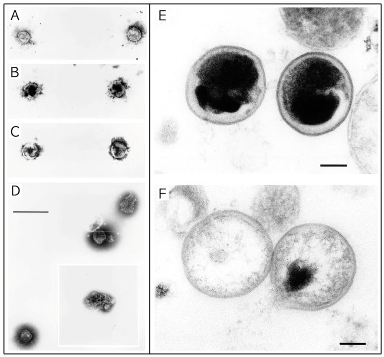 https://cdn.ncbi.nlm.nih.gov/pmc/blobs/d750/5192522/32b5f01b61e9/microorganisms-04-00039-g004.jpg