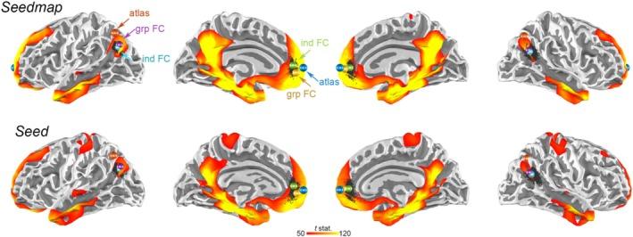 https://cdn.ncbi.nlm.nih.gov/pmc/blobs/d75a/11979967/2c21688784ff/HBM-46-e70167-g003.jpg