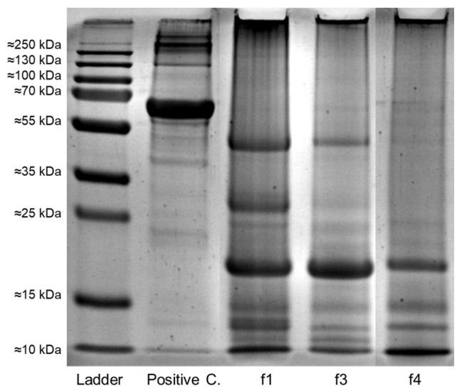 https://cdn.ncbi.nlm.nih.gov/pmc/blobs/d75c/11121351/5aee656bdbc8/foods-13-01536-g009.jpg