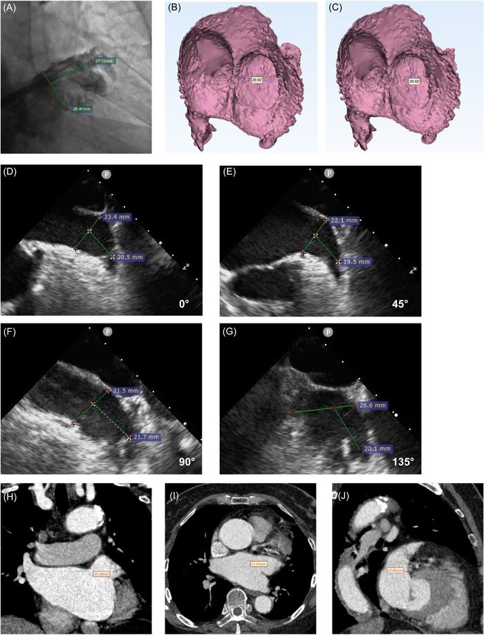 https://cdn.ncbi.nlm.nih.gov/pmc/blobs/d764/9346965/8417acb24321/CLC-45-864-g002.jpg