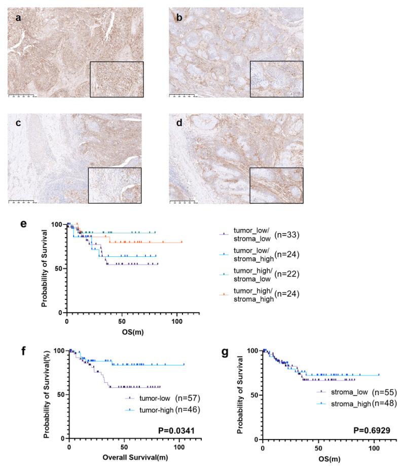 https://cdn.ncbi.nlm.nih.gov/pmc/blobs/d76a/11171371/5616430e62ac/cancers-16-02140-g002.jpg