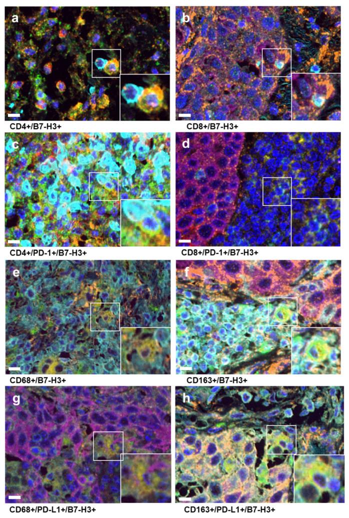 https://cdn.ncbi.nlm.nih.gov/pmc/blobs/d76a/11171371/985cabb405de/cancers-16-02140-g001.jpg