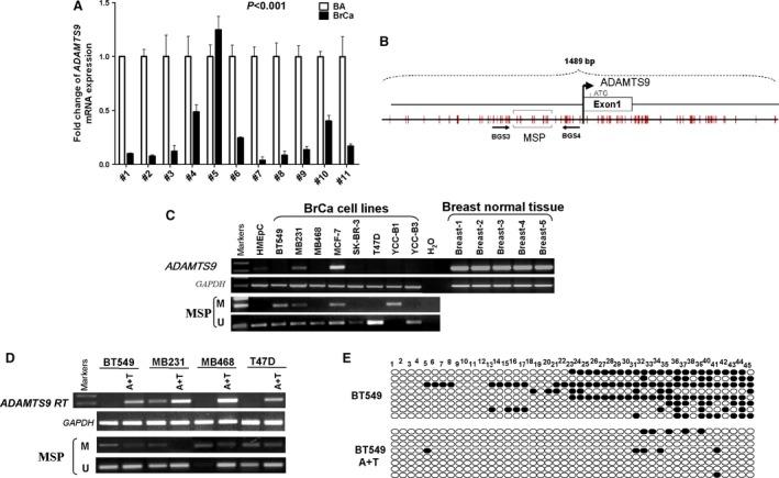 https://cdn.ncbi.nlm.nih.gov/pmc/blobs/d77a/5783842/637a0f205b47/JCMM-22-1257-g001.jpg