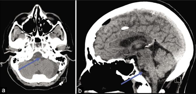 https://cdn.ncbi.nlm.nih.gov/pmc/blobs/d77b/8247734/0e3efe617749/SNI-12-287-g003.jpg