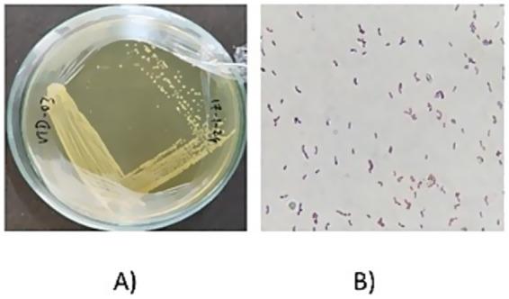 https://cdn.ncbi.nlm.nih.gov/pmc/blobs/d77e/12287088/970e61403302/fmicb-16-1625659-g001.jpg