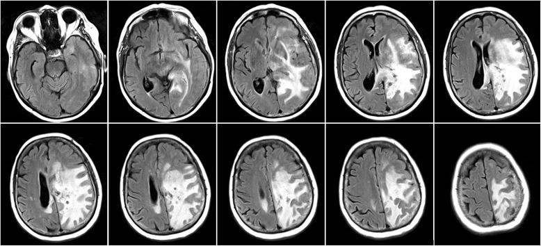 https://cdn.ncbi.nlm.nih.gov/pmc/blobs/d781/4744425/2defda987813/12883_2016_543_Fig1_HTML.jpg