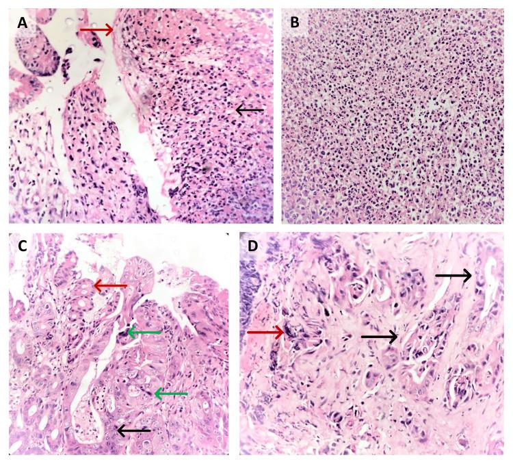 https://cdn.ncbi.nlm.nih.gov/pmc/blobs/d78d/11750052/3a802b8e9a65/cureus-0016-00000076196-i03.jpg