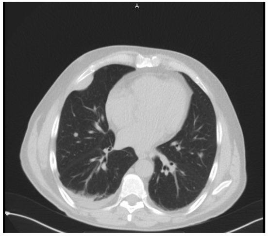 https://cdn.ncbi.nlm.nih.gov/pmc/blobs/d78d/4356396/f5950adfec8c/OL-09-04-1937-g02.jpg