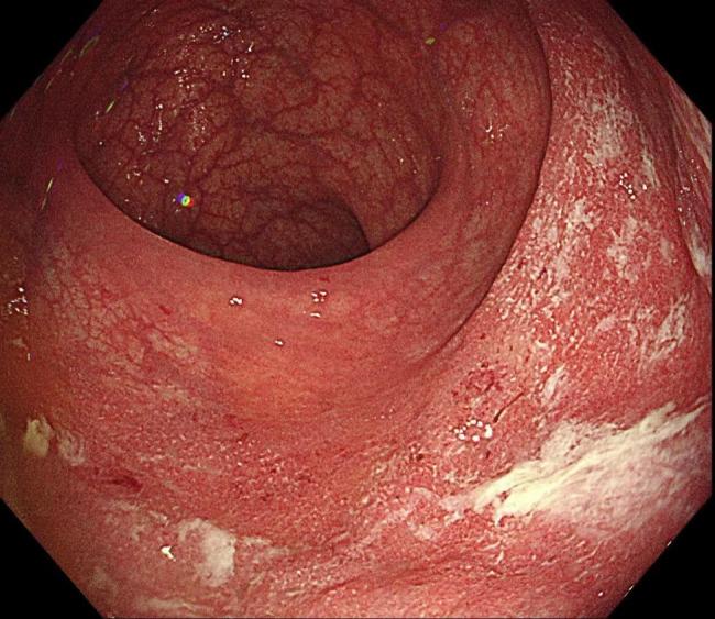 https://cdn.ncbi.nlm.nih.gov/pmc/blobs/d792/11472470/9d778d213513/12876_2024_3436_Fig2_HTML.jpg