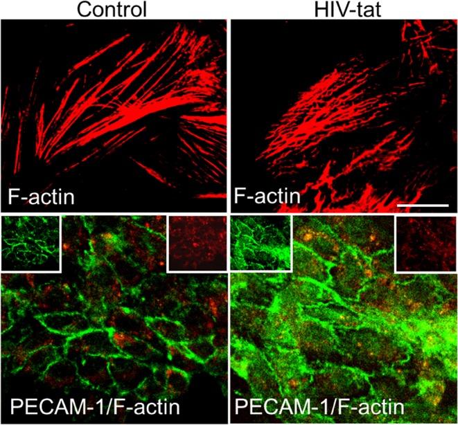 https://cdn.ncbi.nlm.nih.gov/pmc/blobs/d797/7052126/05c8bf3a3077/fcimb-10-00061-g0002.jpg