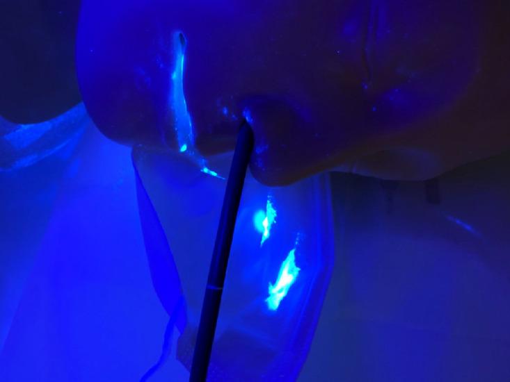 https://cdn.ncbi.nlm.nih.gov/pmc/blobs/d79e/8357582/af592aa50143/ce-2020-291f3.jpg