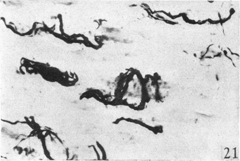 https://cdn.ncbi.nlm.nih.gov/pmc/blobs/d7a6/1272667/fd33d73c090c/janat00497-0029-c.jpg