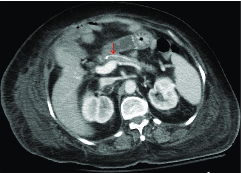https://cdn.ncbi.nlm.nih.gov/pmc/blobs/d7a7/6160612/7d6162be6ae4/CG-CGCR180058F002.jpg