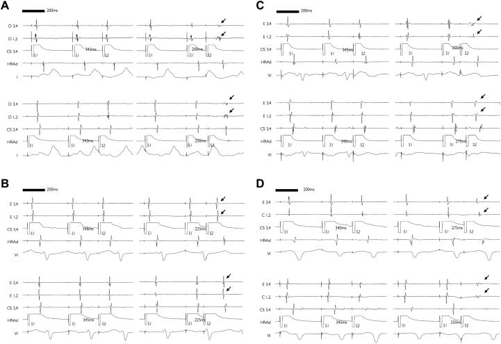 https://cdn.ncbi.nlm.nih.gov/pmc/blobs/d7ad/5612260/c48bf71f1a48/gr2.jpg
