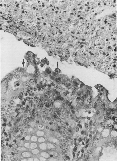 https://cdn.ncbi.nlm.nih.gov/pmc/blobs/d7b5/358168/ebf85953869e/cmr00049-0071-a.jpg
