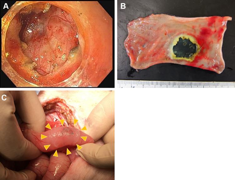 https://cdn.ncbi.nlm.nih.gov/pmc/blobs/d7bb/7784576/d7b52b5e326f/10.1177_0963689720963882-fig2.jpg