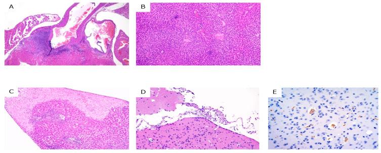https://cdn.ncbi.nlm.nih.gov/pmc/blobs/d7bb/8956101/0ed0b2adf080/pathogens-11-00331-g003.jpg
