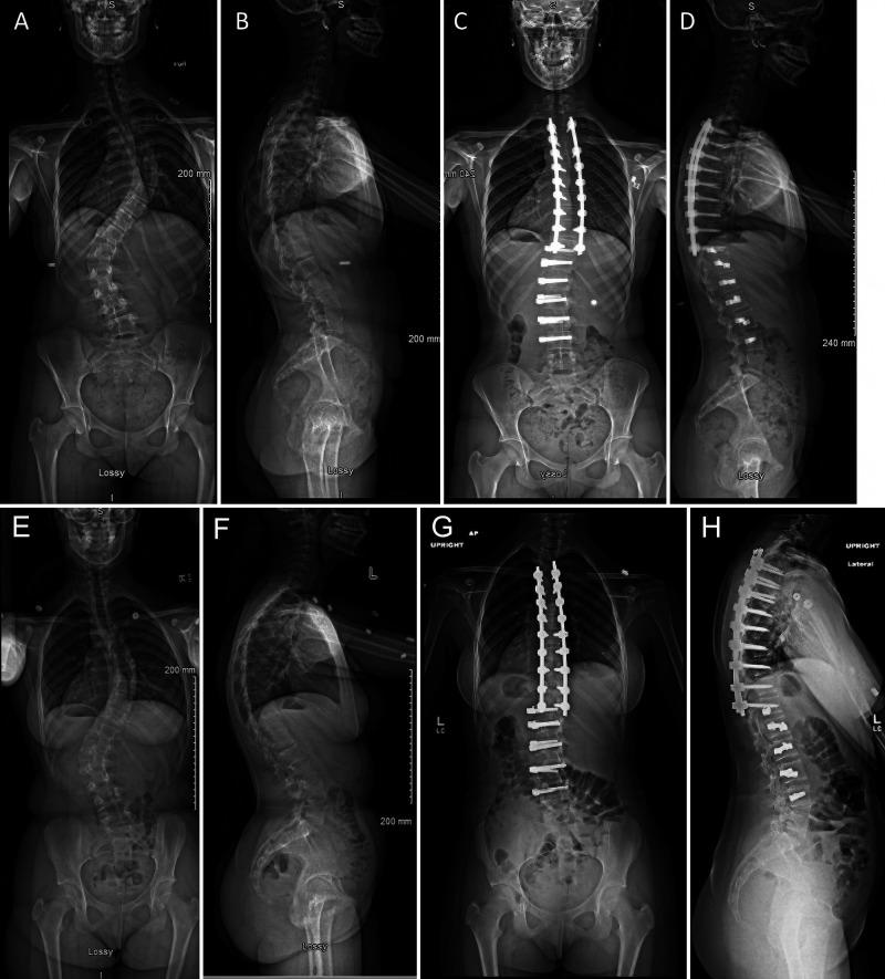 https://cdn.ncbi.nlm.nih.gov/pmc/blobs/d7c4/10566524/2ee3e3805ffa/CASE23331f3.jpg