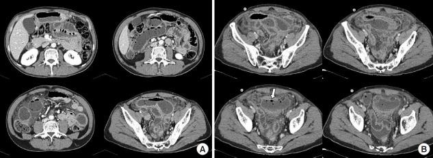 https://cdn.ncbi.nlm.nih.gov/pmc/blobs/d7ca/8359699/52c17278edc0/ac-2020-03-16-1f4.jpg