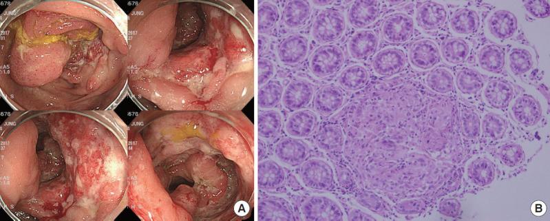 https://cdn.ncbi.nlm.nih.gov/pmc/blobs/d7ca/8359699/9244bc1bcde0/ac-2020-03-16-1f1.jpg