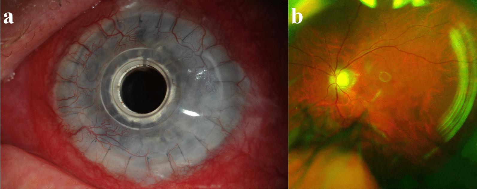 https://cdn.ncbi.nlm.nih.gov/pmc/blobs/d7d3/9077933/f657fa091063/40662_2022_289_Fig1_HTML.jpg