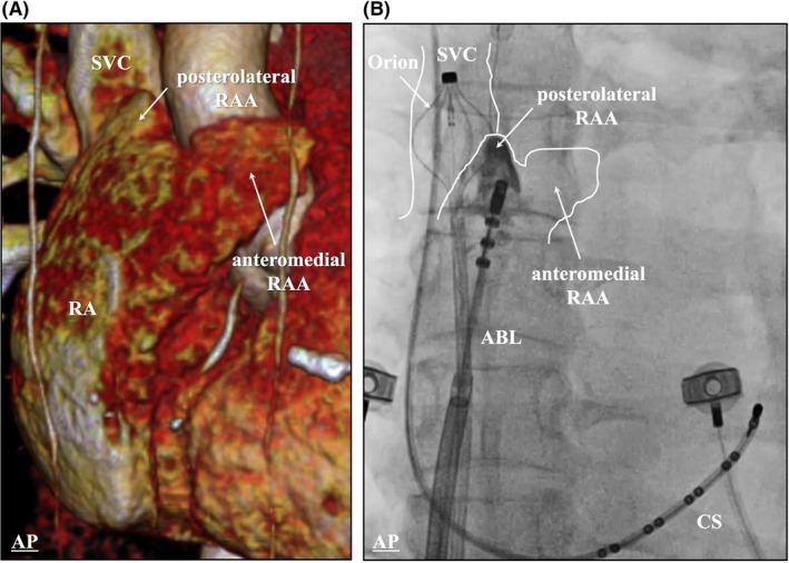 https://cdn.ncbi.nlm.nih.gov/pmc/blobs/d7e3/8851579/0a12998fddee/JOA3-38-157-g003.jpg
