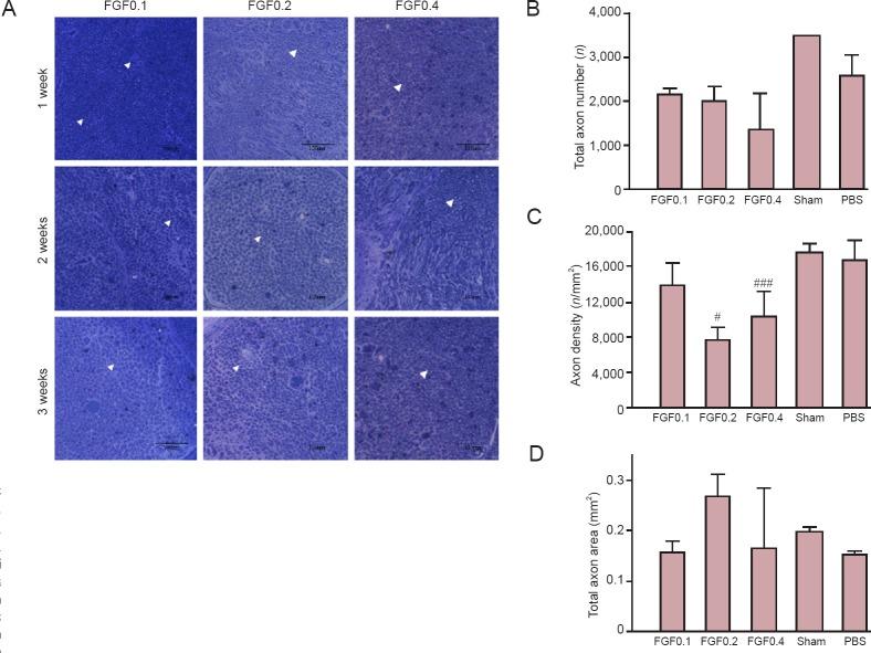 https://cdn.ncbi.nlm.nih.gov/pmc/blobs/d7f0/5436363/12a860e5a566/NRR-12-629-g006.jpg