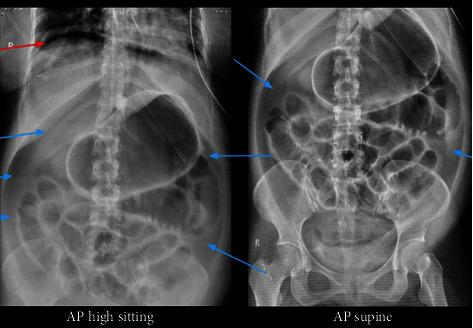 https://cdn.ncbi.nlm.nih.gov/pmc/blobs/d7f4/10017220/989214f317fa/CRIM2023-7737433.003.jpg
