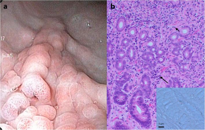 https://cdn.ncbi.nlm.nih.gov/pmc/blobs/d7f5/7923814/8d1a1e3fa1d6/12917_2021_2802_Fig2_HTML.jpg