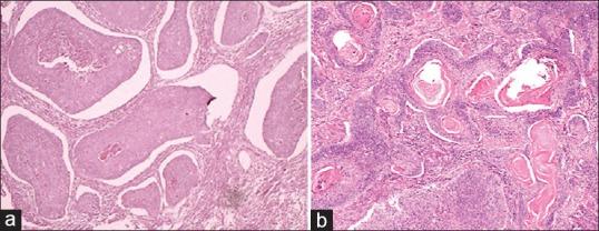 https://cdn.ncbi.nlm.nih.gov/pmc/blobs/d7fc/5596693/e125dcb36bb2/JOMFP-21-320a-g005.jpg