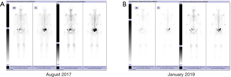 https://cdn.ncbi.nlm.nih.gov/pmc/blobs/d803/7354285/735ccbd67f64/tau-09-03-1448-f6.jpg
