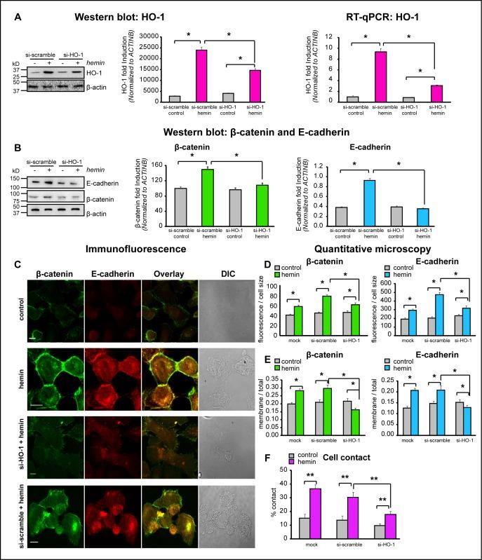 https://cdn.ncbi.nlm.nih.gov/pmc/blobs/d804/4147308/4aaa16d303dd/oncotarget-05-4087-g005.jpg