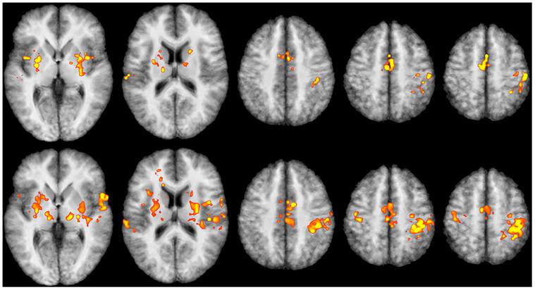 https://cdn.ncbi.nlm.nih.gov/pmc/blobs/d805/4325335/0a8cb7a84e90/srep08413-f3.jpg