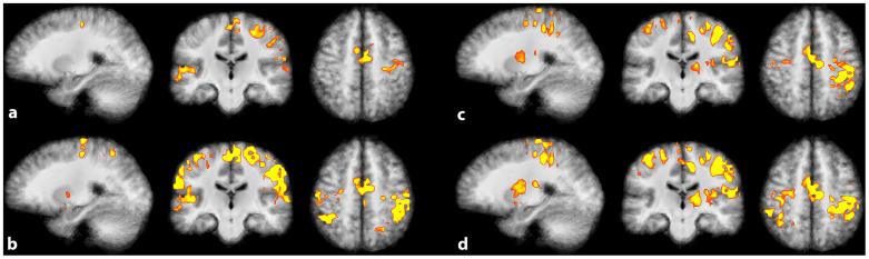 https://cdn.ncbi.nlm.nih.gov/pmc/blobs/d805/4325335/a977295a8b1d/srep08413-f2.jpg