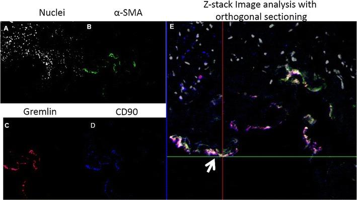 https://cdn.ncbi.nlm.nih.gov/pmc/blobs/d808/5146849/ae66bfc7bcf3/12967_2016_1091_Fig3_HTML.jpg